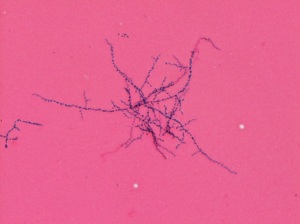 Gram stain of growth from the AFB bottle showing beaded, branch Gram positive bacilli. 