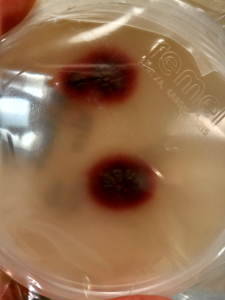 Colony morphology with deep purple red pigmentation.